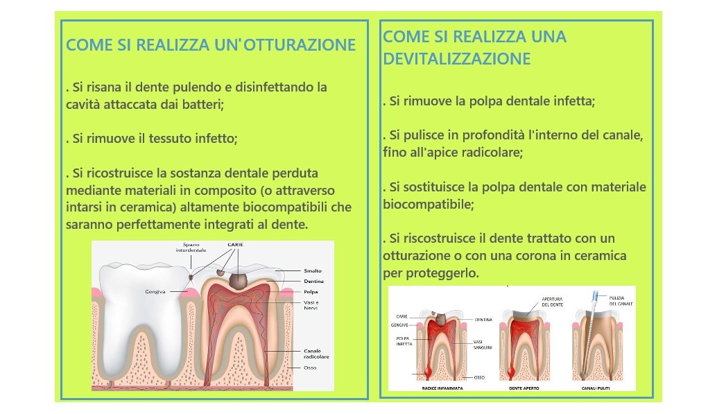 OTTURAZIONE O DV