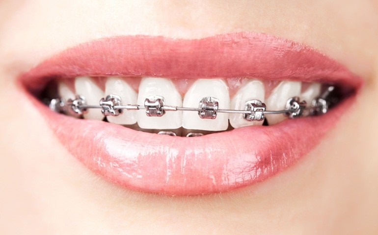 dentista-ortodonzia-voghera