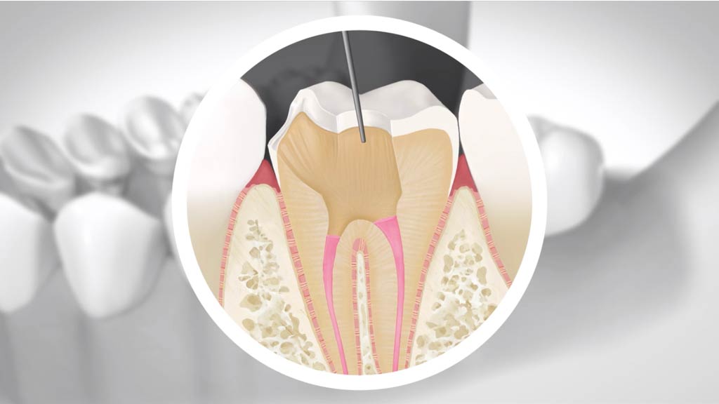 endodonzia-denti