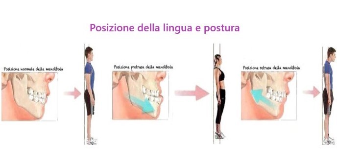 posizione-lingua-postura-odontoiatria