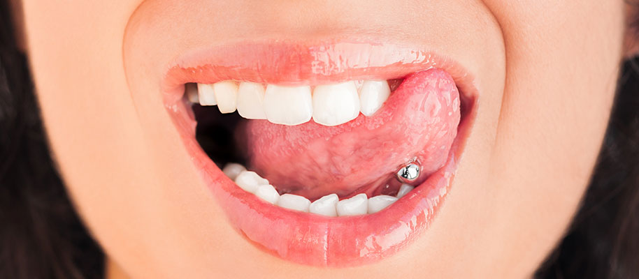 piercing-dentista